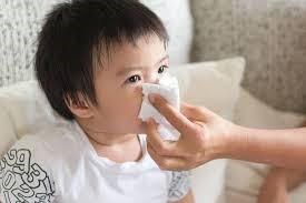 Nguyên nhân bé yêu bị sổ mũi kéo dài